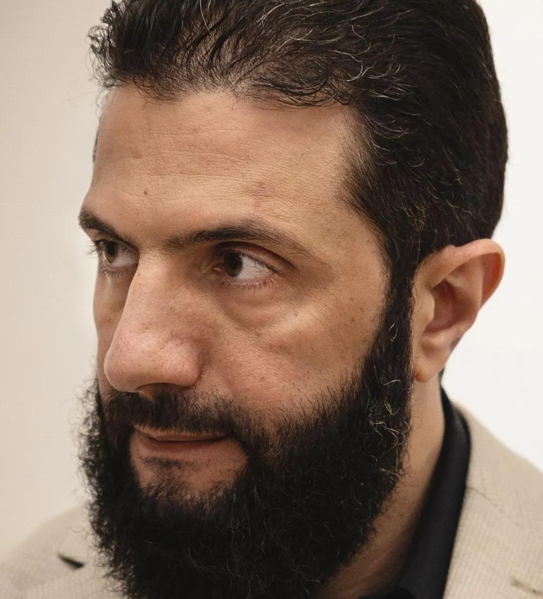 看看朱拉尼面部大特定,和以前拍的漂亮相片不同。他的脸黄黄的,不干净,还有雀斑和黄