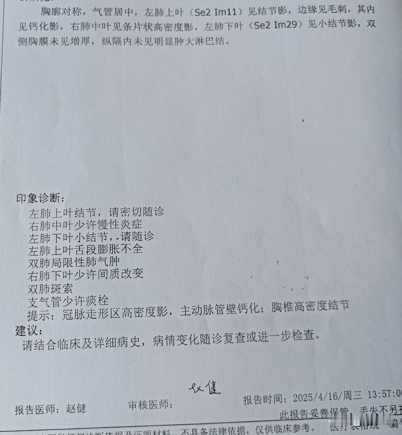 我妹妹感到胸部疼痛，咳白痰，去医院拍CT，发现两肺有结节，左肺结节边缘有毛刺！