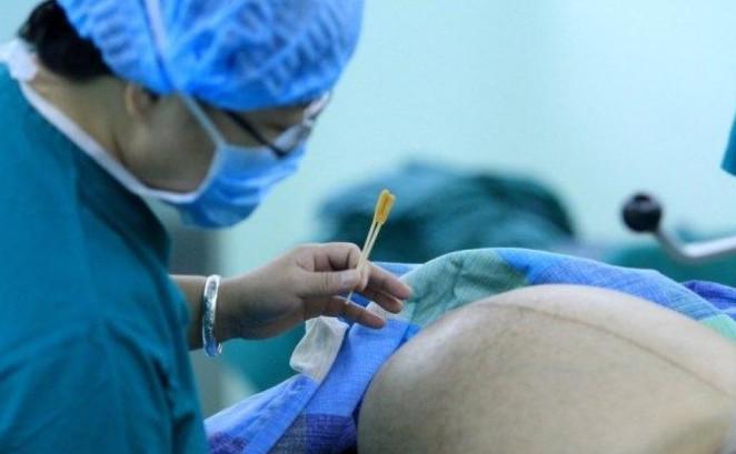 女子辛苦剖腹产迎来三胞胎宝宝, 知道孩子性别后家人放心了