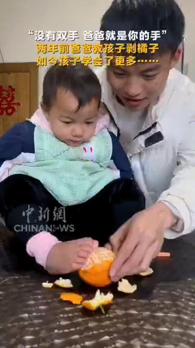 宝宝没有双手，爸爸就是你的双手…视频中的宝宝叫瑞瑞，她很不幸，生下来就没有双臂