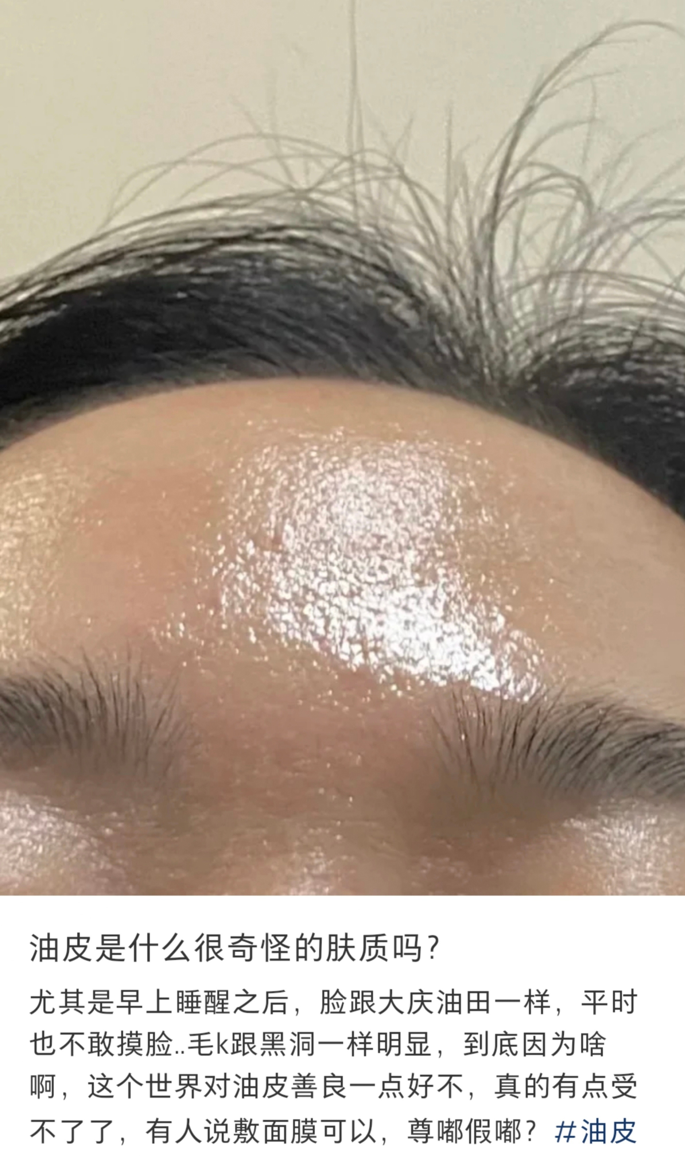 这个世界对油皮充满恶意