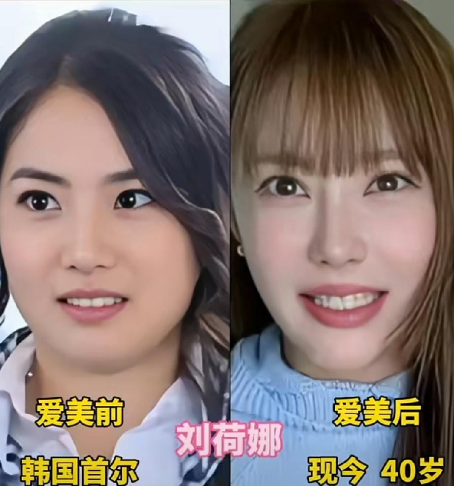 本来个个都是纯天然的绝世颜值，可过度执着医美之后，颜值直接大跌，哪一位最让你惋惜