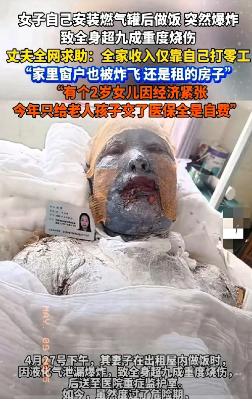 打工妈妈60万治疗费从哪里来？女子液化气罐爆炸，全身烧伤严重，需