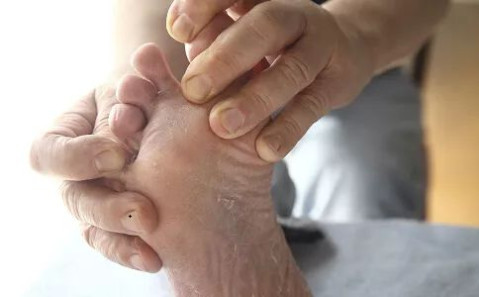 9如果脚部 出现水泡,红肿,老茧等问题,不要自己盲目处理,应到大型综合