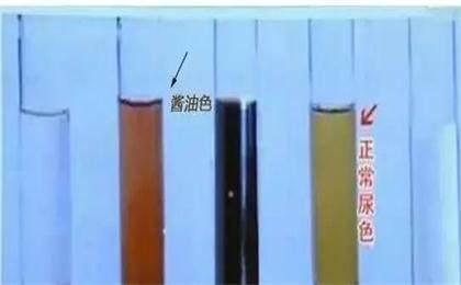 海底捞百度百科,海底捞你学不会百度云_为什么