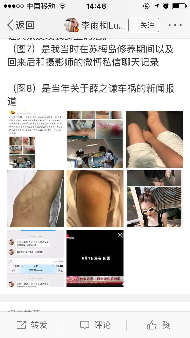 李雨桐第三次控诉薛之谦欺骗观众, 有图为证! 薛之谦继续当缩头乌龟吗?