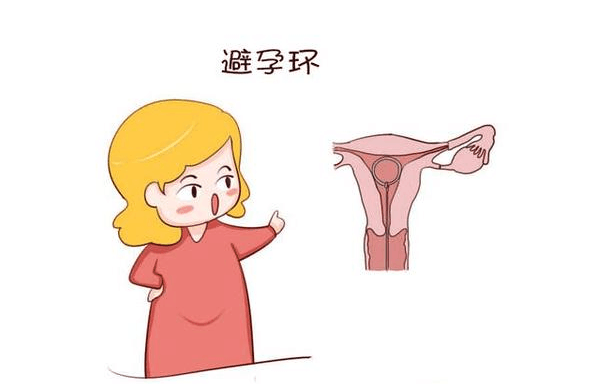 取节育环到底有多疼? 准备要二胎的宝妈看看了