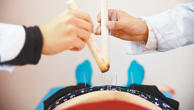 自4月8日起北京针灸价格从每次4元调整为26元