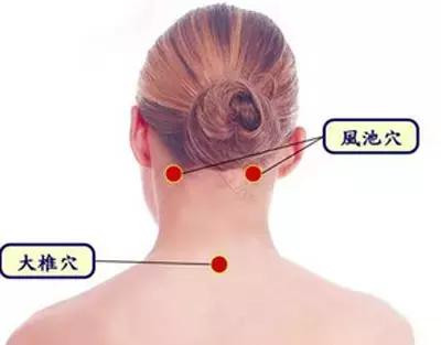 拔罐方法不对=缩短生命, 中医提醒, 拔火罐的三个禁忌