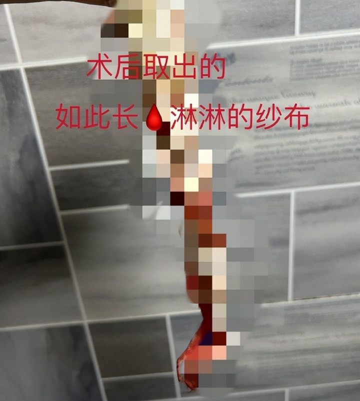 ˸ȾŮHPV! Գ˯73Ů, Լ(ͷ˵)