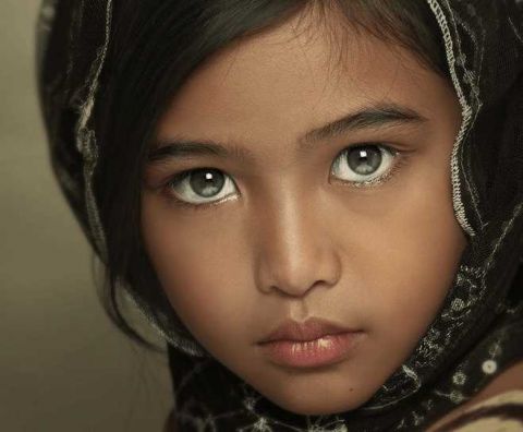一个普通的小女孩, 因为一双特殊的眼睛, 全世界都认识了她