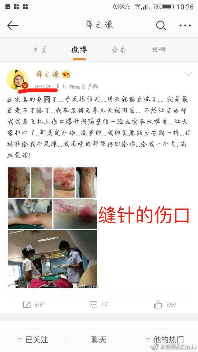 李雨桐第三次控诉薛之谦欺骗观众, 有图为证! 薛之谦继续当缩头乌龟吗?