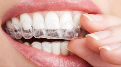 全国爱牙日: 牙齿不齐只是影响美观吗? 答案是NO