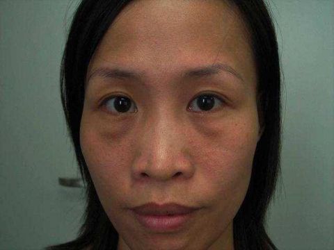 肌肤会越来越老化,斑点和肌肤暗黄会越来越严重,肌肤不再水嫩,不再有