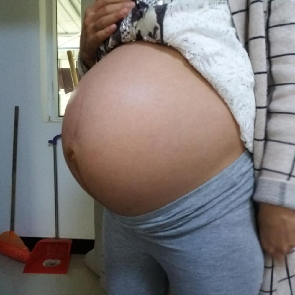 11月6号剖腹产儿子一枚, 儿女双全了