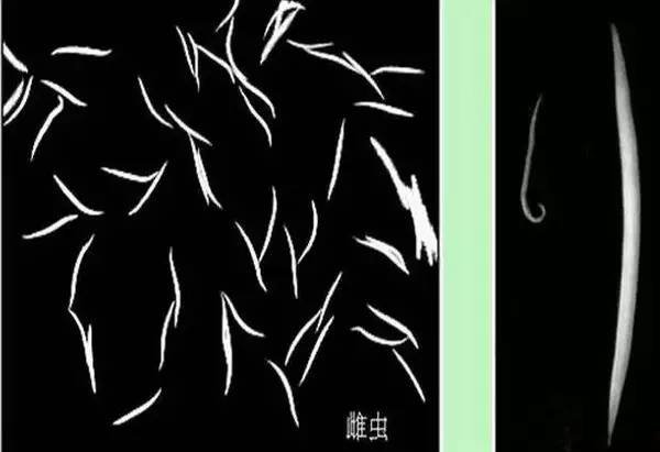 3岁女孩拉出密密麻麻的细线, 医生的话让妈妈感到委屈又羞愧!