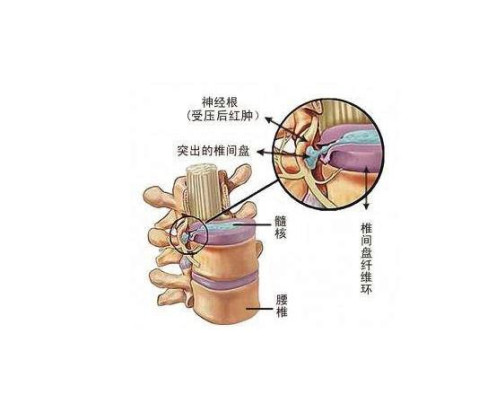 直立兩足分開,兩手叉腰,做腰背的前後左右屈伸運動,儘量放鬆腰背部