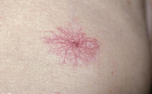 人体有这五个征兆时, 表明肝脏出现大问题了!