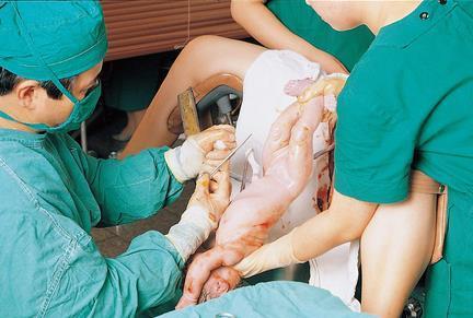 顺产前一个小时, 所有孕妈都躲不过的几样罪