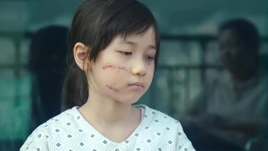 素媛原型娜英伤口照片图片大全素媛娜英真人照片2022已更新今日更新