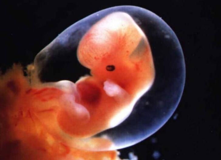 试管婴儿胚胎多少有限制, 不是想要就有的