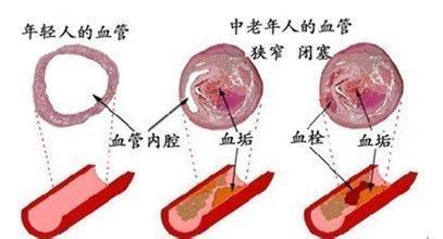 3种血管的“清道夫”, 40岁还不吃, 吃亏的就是你自己