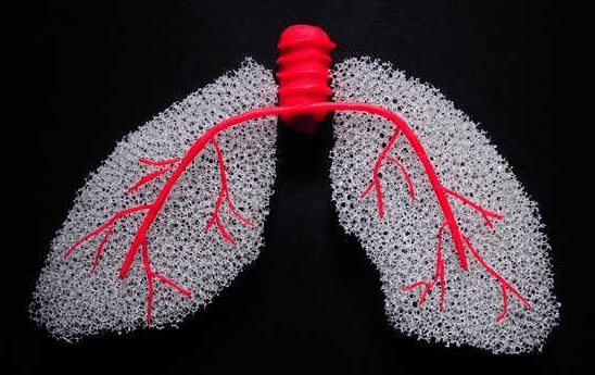 肺癌已成中国第一癌, 帮你计算一下得了肺癌还能活多久