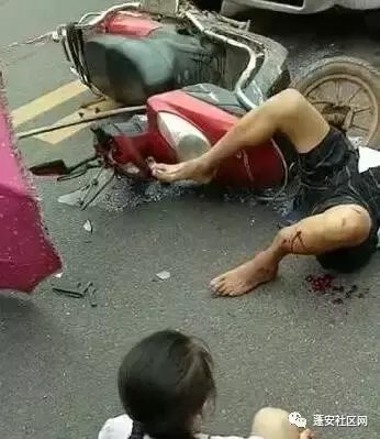 8月25日四川蓬安一辆摩托车与长安车发生碰撞 腿当场撞断, 可怕的弯曲!