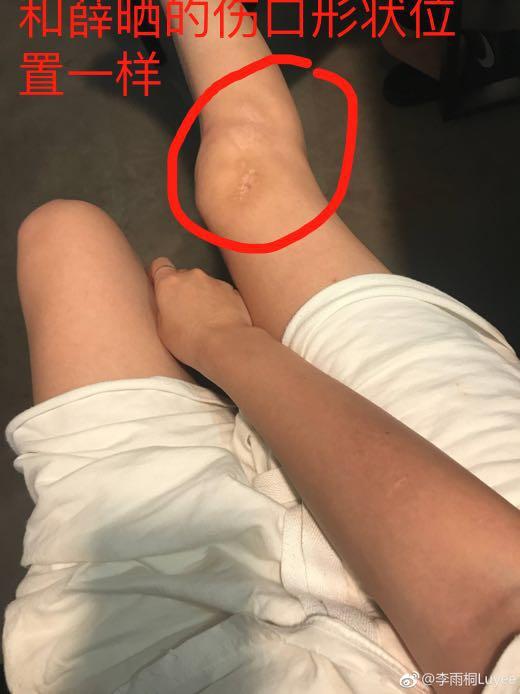 李雨桐第三次控诉薛之谦欺骗观众, 有图为证! 薛之谦继续当缩头乌龟吗?