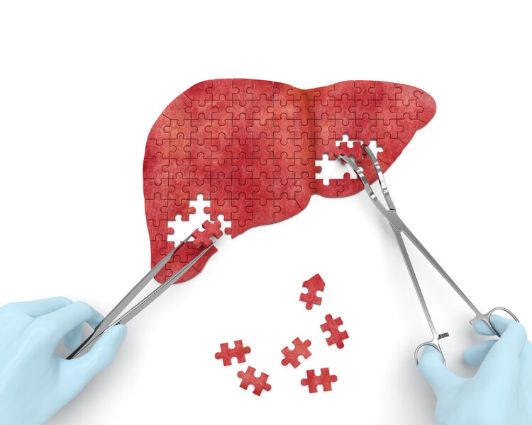 It is difficult to detect liver cancer in the early stage? There are 3 abnormalities in the head, which may be a signal of liver cancer