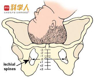 人类分娩史: 为什么分娩对于女人来说如此痛苦?