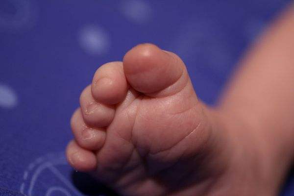 新生儿脚发紫怎么回事 家长应知晓这五大原因