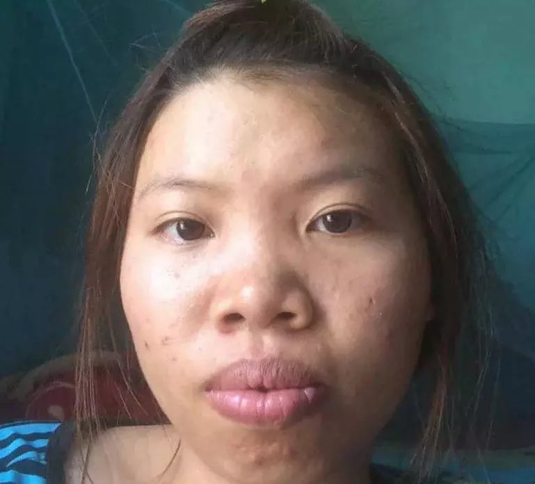越南20岁少女借款10万整容变美女, 成功嫁给富二代