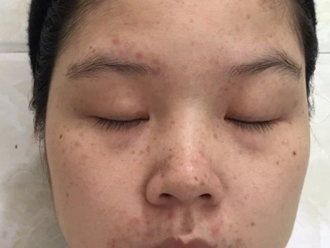 女人过30岁皱纹变多显老态, 早晚涂抹两滴它, 有助于去皱显年轻