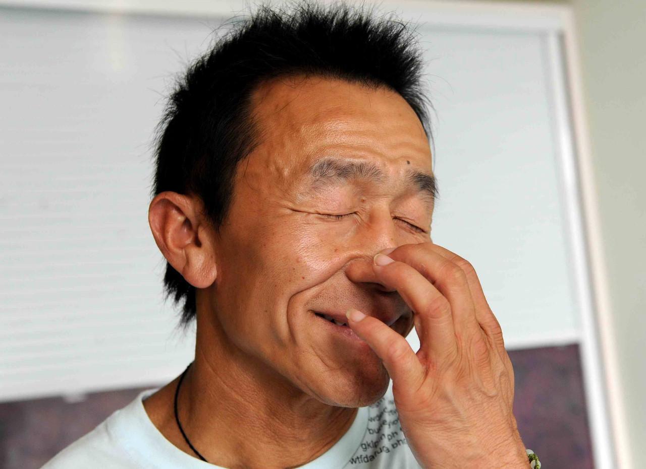 23岁青年早衰,面容酷似老头 3.