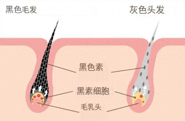 头发白了, 还能变黑吗? 医生的答案出乎意料
