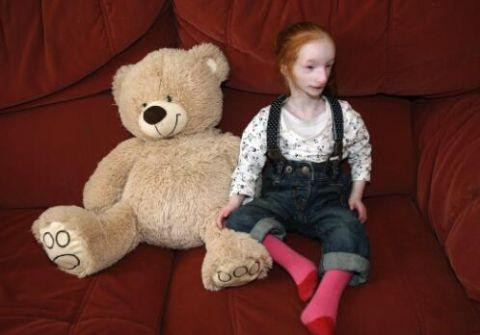 出生就被判死刑的瓷娃娃十年过去被父母宠成小公主