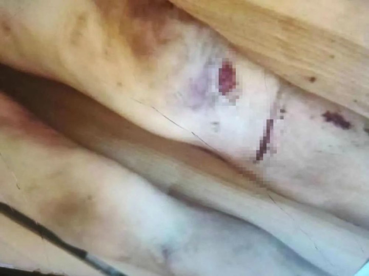 被父母虐待致死的12岁男孩：多次逃跑流浪，临死前被吊在太阳直射的三楼