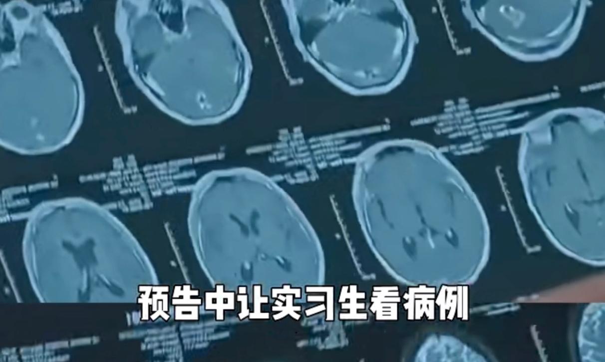10篇SCI仅1篇独立一作！神外博士读片靠盲猜，人设崩塌
