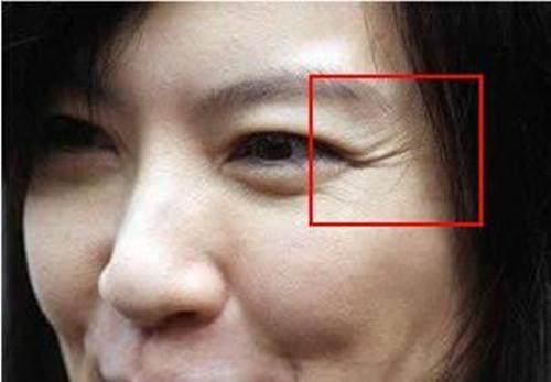 眼角长皱纹又老又丑, 睡前抹点"它", 不出7天眼部如鸡蛋般嫩滑