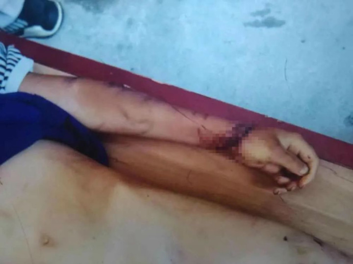 被父母虐待致死的12岁男孩：多次逃跑流浪，临死前被吊在太阳直射的三楼