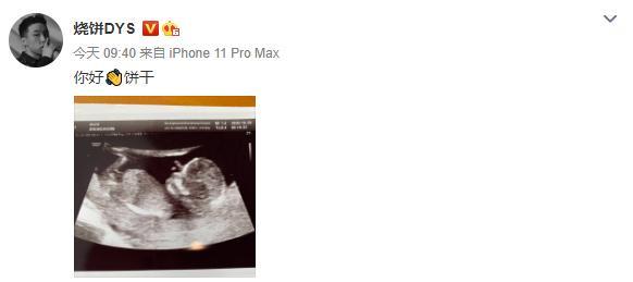 郭德綱徒弟燒餅喜迎二胎, 老婆一月前就自曝懷孕, 孕期顏值不減-圖1