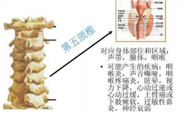 脊柱退化所引發的疾病 您中招了麼