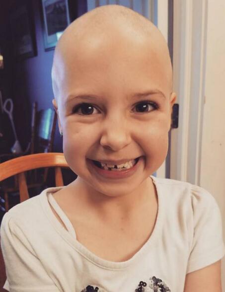 七岁女孩因病失去满头秀发, 没想最后成为最耀眼的明星