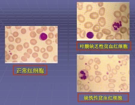 补铁最佳的4大天然食物, 你记住了吗?